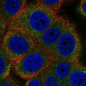 Anti-ALG12 antibody produced in rabbit 