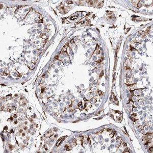 Anti-ALG1L antibody produced in rabbit 