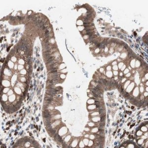Anti-ALG5 antibody produced in rabbit HPA007989-100UL