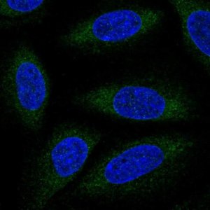 Anti-ALG6 antibody produced in rabbit 