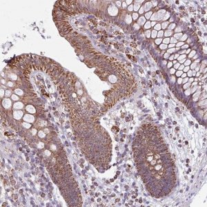 Anti-ALG8 antibody produced in rabbit HPA051898-100UL