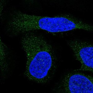 Anti-ALG9 antibody produced in rabbit 