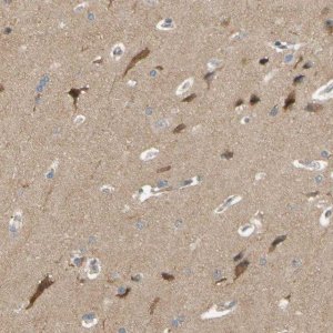 Anti-ALK antibody produced in rabbit 