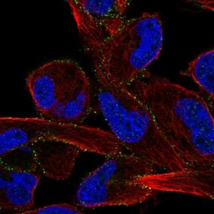 Anti-ALK antibody produced in rabbit 