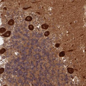 Anti-ALKBH1 antibody produced in rabbit 