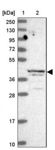 Anti-ALKBH1 antibody produced in rabbit 
