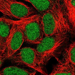 Anti-ALKBH2 antibody produced in rabbit 