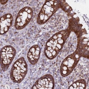 Anti-ALKBH4 antibody produced in rabbit 