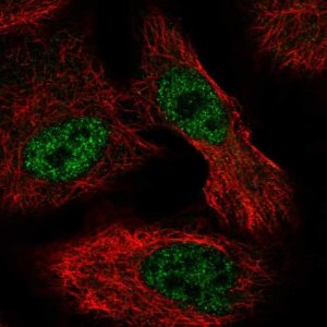 Anti-ALKBH6 antibody produced in rabbit 