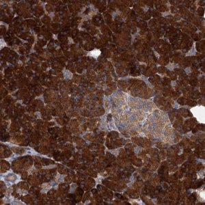 Anti-ALKBH7 antibody produced in rabbit 