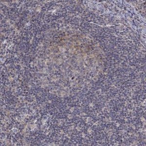 Anti-ALKBH8 antibody produced in rabbit 
