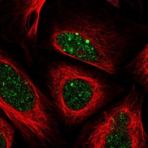 Anti-ALKBH8 antibody produced in rabbit 