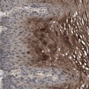 Anti-ALOX12 antibody produced in rabbit 