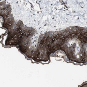 Anti-ALOX12 antibody produced in rabbit 