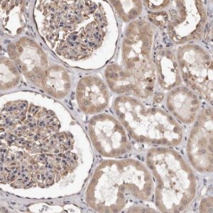 Anti-ALPK1 antibody produced in rabbit 