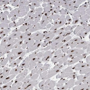 Anti-ALPK3 antibody produced in rabbit 