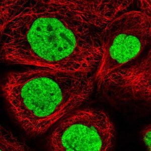 Anti-ALPK3 antibody produced in rabbit 
