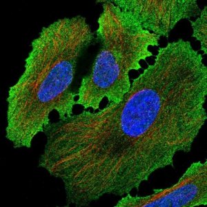 Anti-ALPP antibody produced in rabbit 