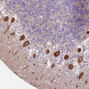 Anti-ALS2 antibody produced in rabbit 