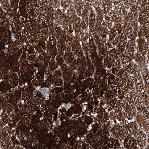 Anti-AMDHD1 antibody produced in rabbit 