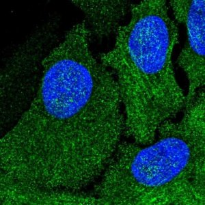 Anti-AMDHD1 antibody produced in rabbit 