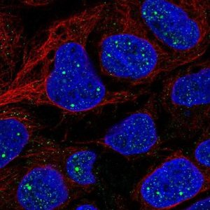 Anti-AMER1 antibody produced in rabbit 