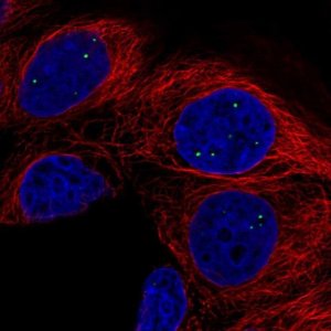 Anti-AMER3 antibody produced in rabbit 