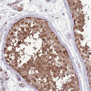 Anti-AMIGO1 antibody produced in rabbit HPA046152-100UL