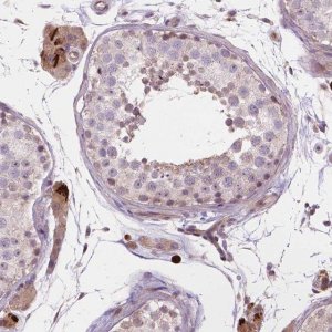 Anti-AMMECR1 antibody produced in rabbit 