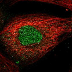 Anti-AMMECR1L antibody produced in rabbit HPA057234-100UL