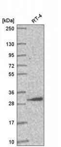 Anti-AMMECR1L antibody produced in rabbit HPA057234-100UL