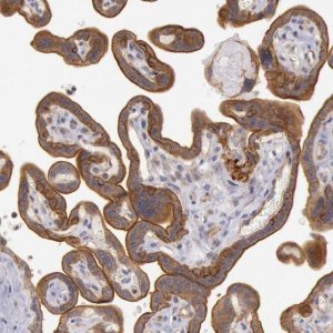 Anti-AMOTL1 antibody produced in rabbit 