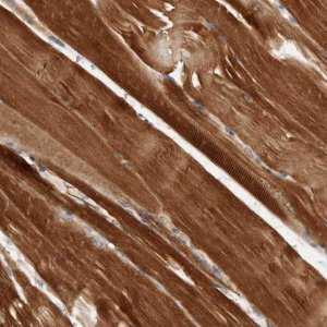 Anti-AMPD1 antibody produced in rabbit 