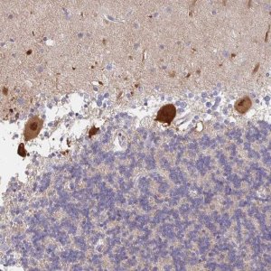Anti-AMPD2 antibody produced in rabbit HPA027137-100UL