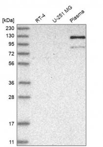 Anti-AMPD2 antibody produced in rabbit HPA027137-100UL