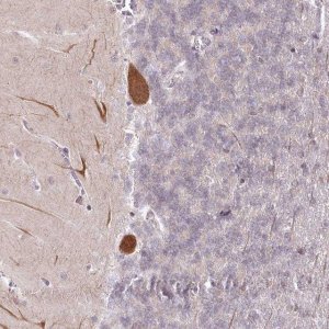 Anti-AMTN antibody produced in rabbit 