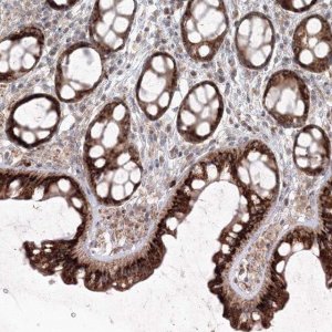 Anti-ANAPC16 antibody produced in rabbit 