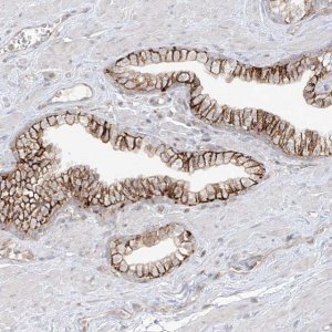 Anti-ANGEL2 antibody produced in rabbit 