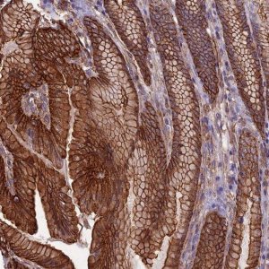 Anti-ANGPTL2 antibody produced in rabbit 