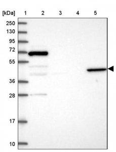 Anti-ANGPTL5 antibody produced in rabbit 