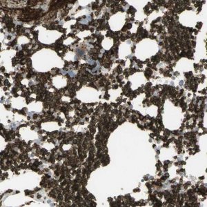 Anti-ANK1 antibody produced in rabbit 