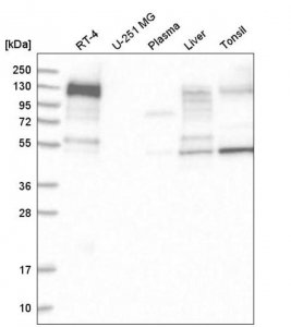 Anti-ANK3 antibody produced in rabbit 