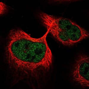 Anti-ANKDD1A antibody produced in rabbit 