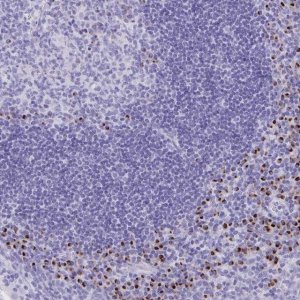 Anti-ANKDD1B antibody produced in rabbit 