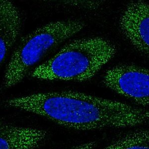 Anti-ANKH antibody produced in rabbit 