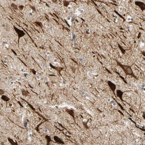 Anti-ANKHD1 antibody produced in rabbit 