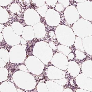 Anti-ANKLE1 antibody produced in rabbit 