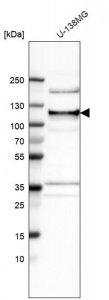 Anti-ANKLE2 antibody produced in rabbit 