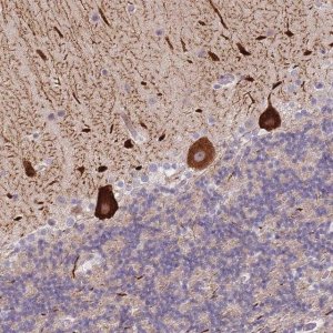 Anti-ANKRD10 antibody produced in rabbit 
