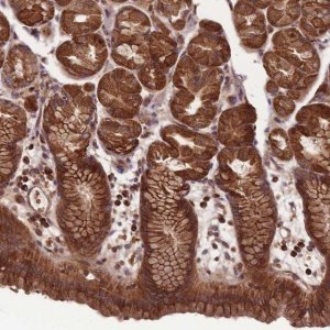 Anti-ANKRD10 antibody produced in rabbit 